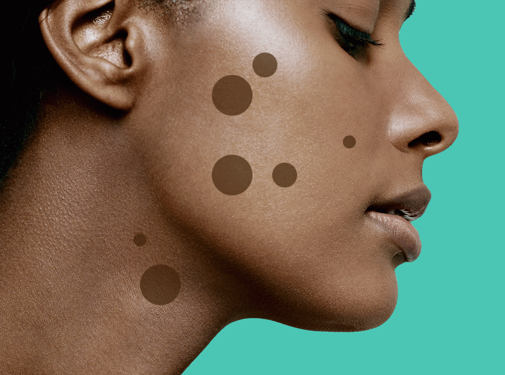 9 Dark Spot Treatments That Really Work, According to Dermatologists