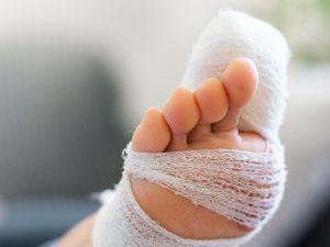 Should I Go to the Hospital for a Broken Toe?